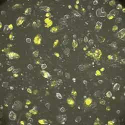 Procesamientos de imágenes de bioluminiscencia, contraste de fases y fluorescencia aplicados en células vivas, incubadas dentro de placas con la base de plástico, mediante el uso de una lente de objetivo con contraste de fases y alta apertura numérica (A. N.) de 20X