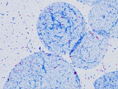 Routine Microscopy