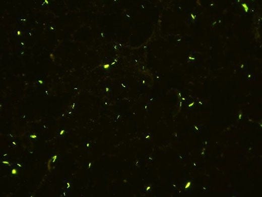 Bacteria de tuberculosis