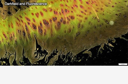 Image d’un cartilage humain prise avec un objectif X Line™ UPLXAPO10X dans cinq modes d’imagerie différents