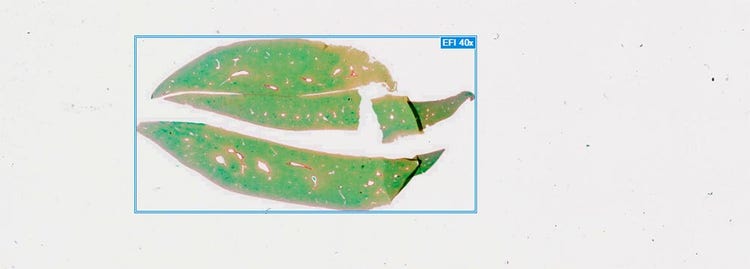 Les lames colorées ont été numérisées avec un scanner de lames pour la recherche Olympus SLIDEVIEW™ VS200 à un grossissement de 40x à l’aide d’un objectif 40x UPlanXApo avec une ouverture numérique de 0,95 pour obtenir la meilleure résolution possible (0,17 μm/pixel).