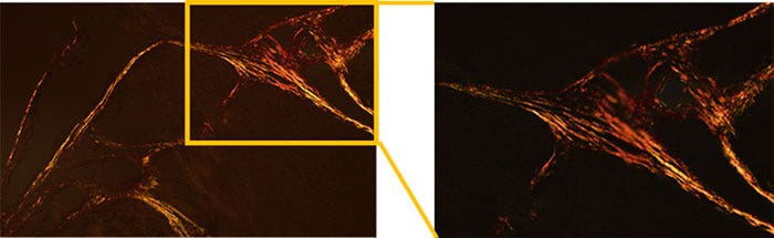 Figure 1 : Lampe halogène de 100 W