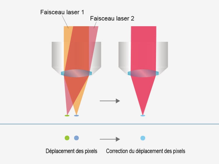 Une imagerie conviviale avec alignement du laser automatisé