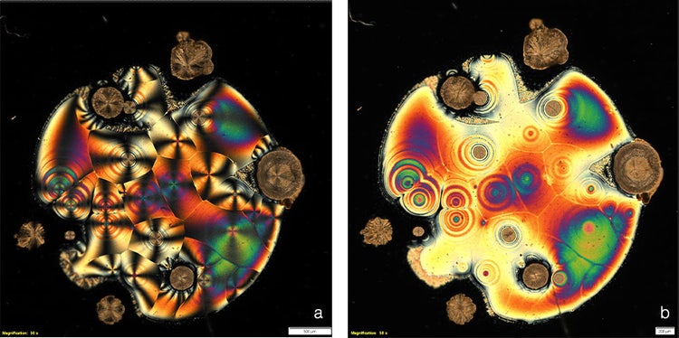 Images de vitamine C réalisées par microscopie en lumière polarisée linéairement et circulairement