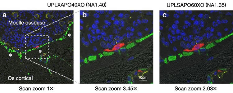 Figure 2 : Images en fluorescence d’une coupe transversale d’un tibia de souris.