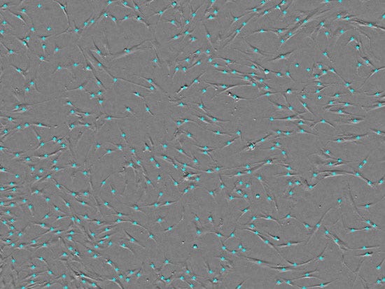Fig. 2. Acquisition d’images CSM et décompte de cellules à l’aide du système CM20