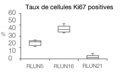 Taux de cellules Ki67 positives