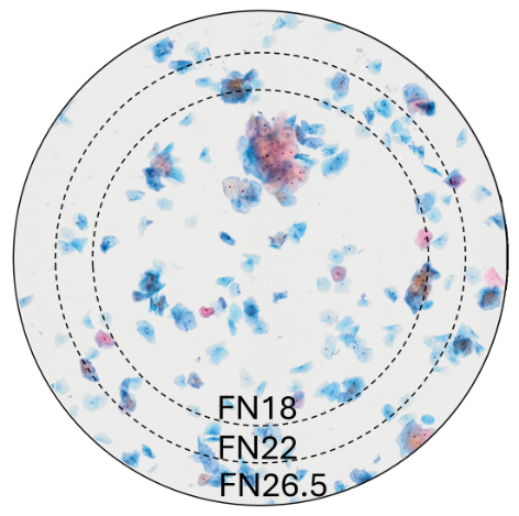 Figure 2. Mince couche de cellules. Champ d’observation à un grossissement de x20 pour FN18, FN22 et FN26,5.