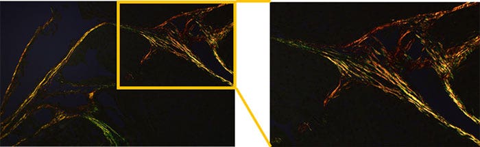 Figure 2 : Microscope BX53 équipé d’une LED Olympus haute luminosité et à rendu colorimétrique élevé