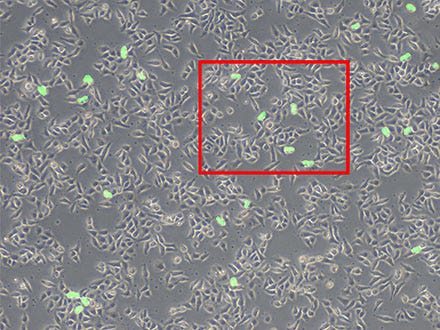 Figure 6 : Prédiction des cellules mitotiques au moyen de la technologie TruAI (vert).