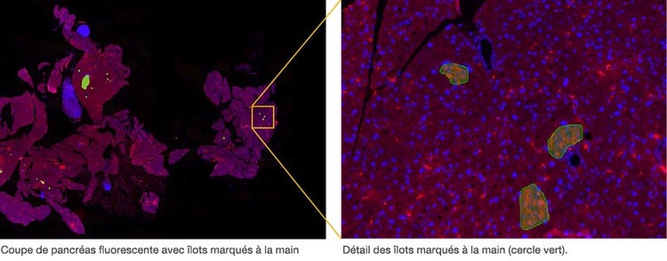 Coupe de pancréas fluorescente avec îlots marqués à la main / Détail des îlots marqués à la main (cercle vert).