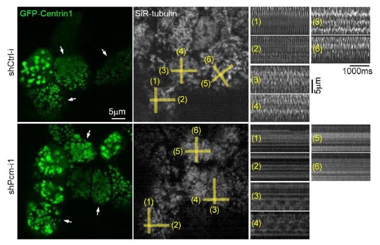 Figure 4. La suppression de PCM1 entraîne une motilité ciliaire anormale des CETS.
