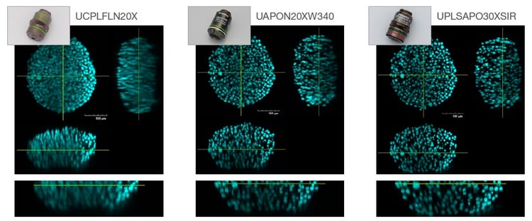 Fig. 2. Conséquences du choix de l’objectif sur la résolution des images. Gauche : sec (IR : 1,00, UCPLFLN20X). Milieu : eau (IR : 1,33, UAPON20XW340). Droite : silicone (IR : 1,40, UPLSAPO30XSIR).