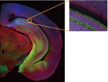 Le laser confocal FV3000