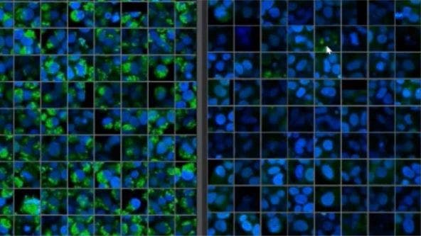 NoviSight™ Demonstration: 3D Image Analysis and Statistical Software for Organoids and Spheroids