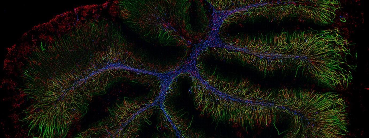 Comment éliminer le flou des images des échantillons épais sans passer par l’approche confocale