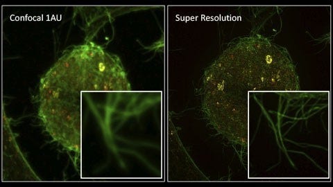 Live Cell Super Resolution Imaging: The Big Picture of Small Things