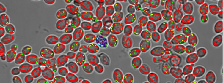 Yeasts imaged with the scanR high-content screening system and analyzed with TruAI deep-learning technology.