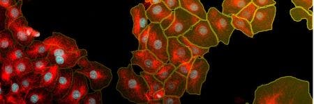 Segmentation d’instances de noyaux et de cellules à l’aide de l’apprentissage profond