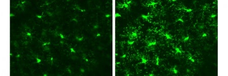Imagerie en profondeur du cortex visuel d’une souris vivante par microscopie multiphotonique