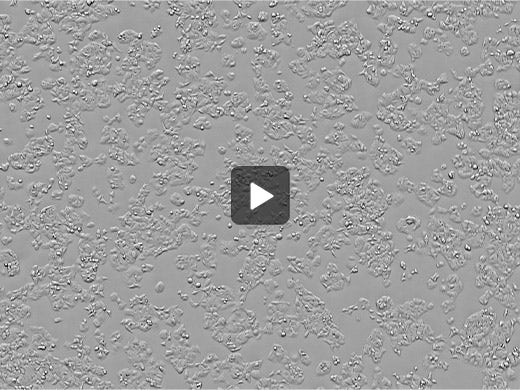 Human hepatoma cell line