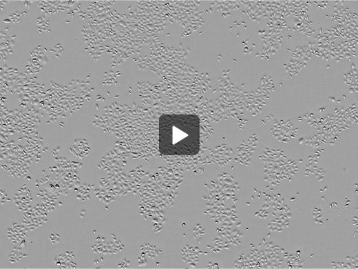 Normal Human Epidermal Keratinocytes