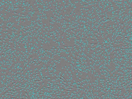 Cell count : Cell count : 1.72 × 10³