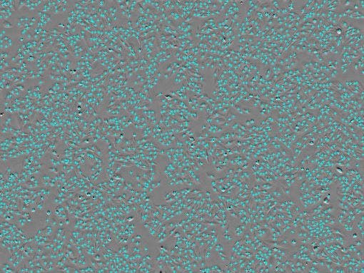 Cell count : 2.77 × 10³