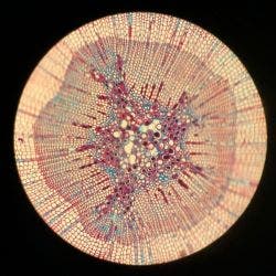 Coupe transversale d’une tige de pin observée au microscope