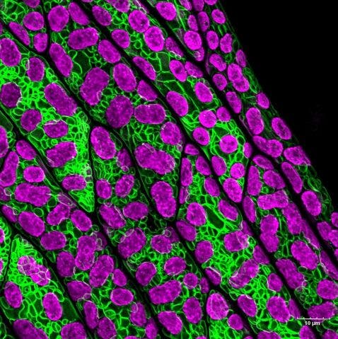 Cellules foliaires d’un gamétophore de mousse observées au microscope