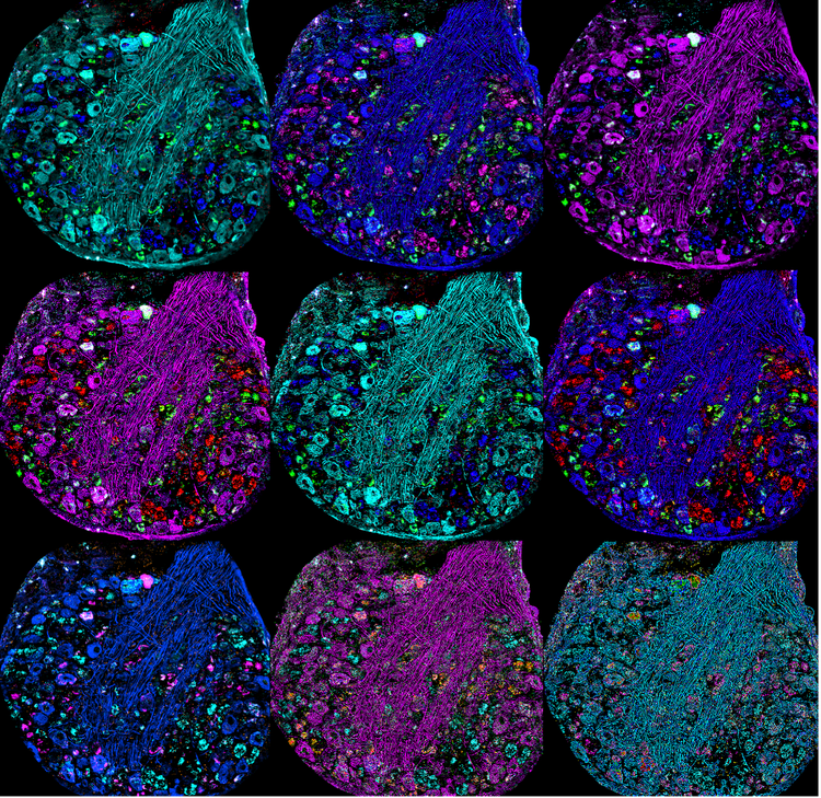 Image stylisée d’un ganglion de racine dorsale de souris prise au microscope