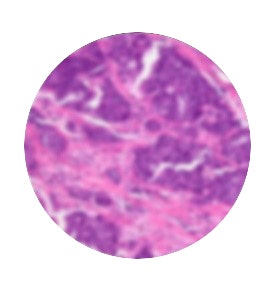 Image floue lors de l’utilisation de l’objectif de plus faible grossissement pour le réglage de l’éclairage de Köhler