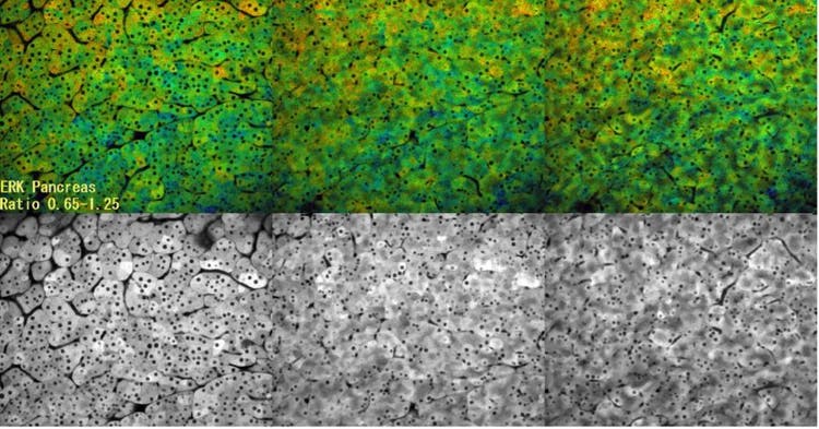 Pancréas de souris observé au microscope