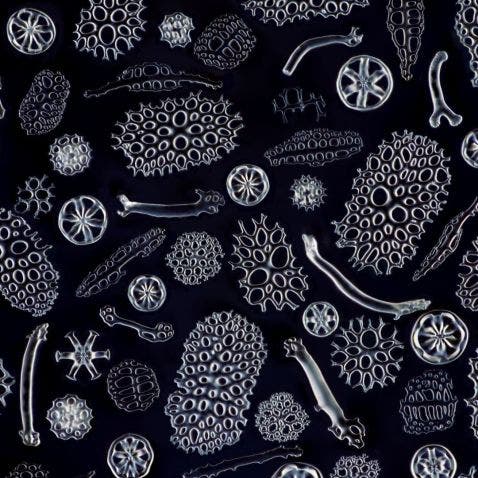 Fragments d’os dans des concombres de mer observés au microscope