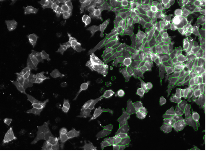 Segmentation d’images de cellules SK-HEP-1 par apprentissage profond