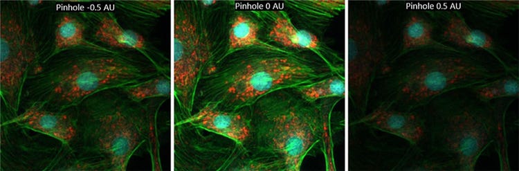 Images acquises avec le sténopé déplacé vers le négatif (à gauche), centré (au milieu) et déplacé vers le positif (à droite) montrant l’incidence du désalignement sur la qualité de l’image.
