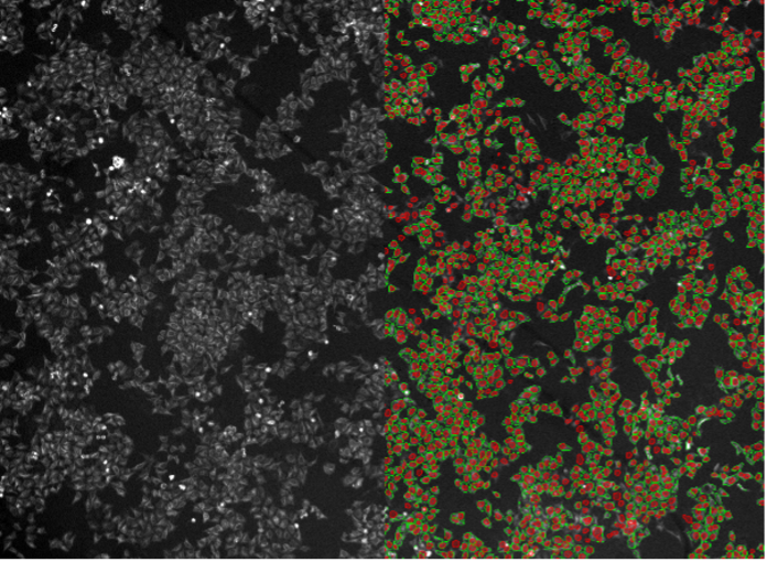 Segmentation d’images de cellules HeLa par apprentissage profond