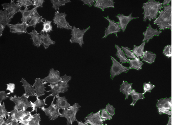 Segmentation d’images de cellules Rat-1 par apprentissage profond