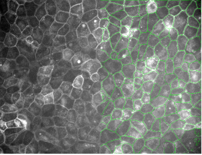 Segmentation d’images de cellules végétales par apprentissage profond