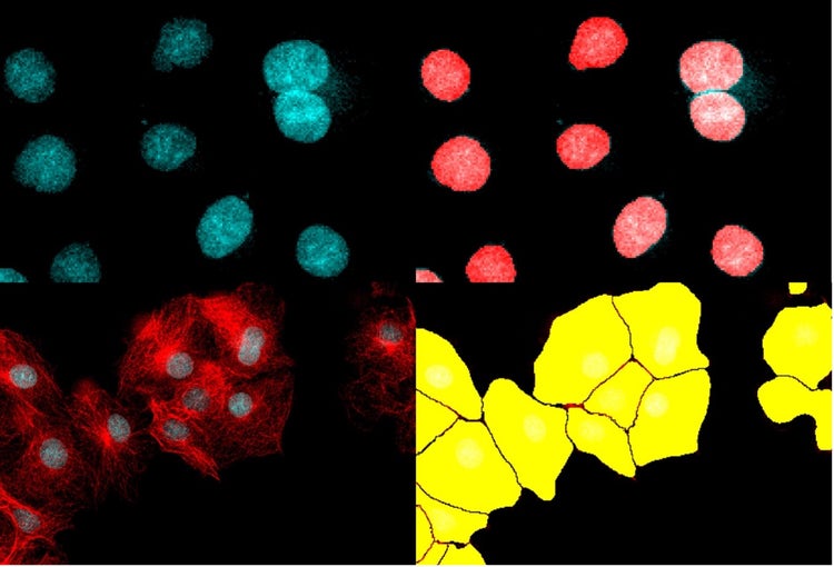 Segmentation d’instances de noyaux et de cellules à l’aide de l’apprentissage profond