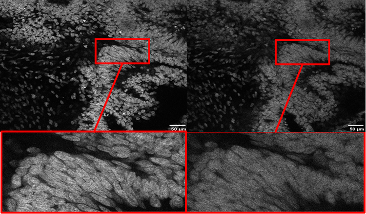 Comparaison d’images avec un objectif sec avant et après utilisation d’un objectif à immersion dans l’huile de silicone.