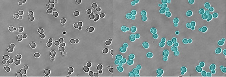 Segmentation d’instances d’une levure sur fond clair