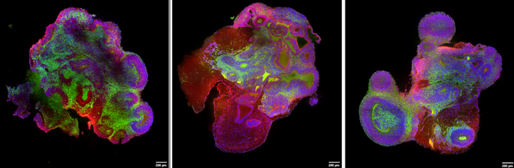 Imagerie multiposition avec un objectif à immersion dans un gel de silicone, montrant l’imagerie réussie de tous les organoïdes avec une haute qualité d’image.