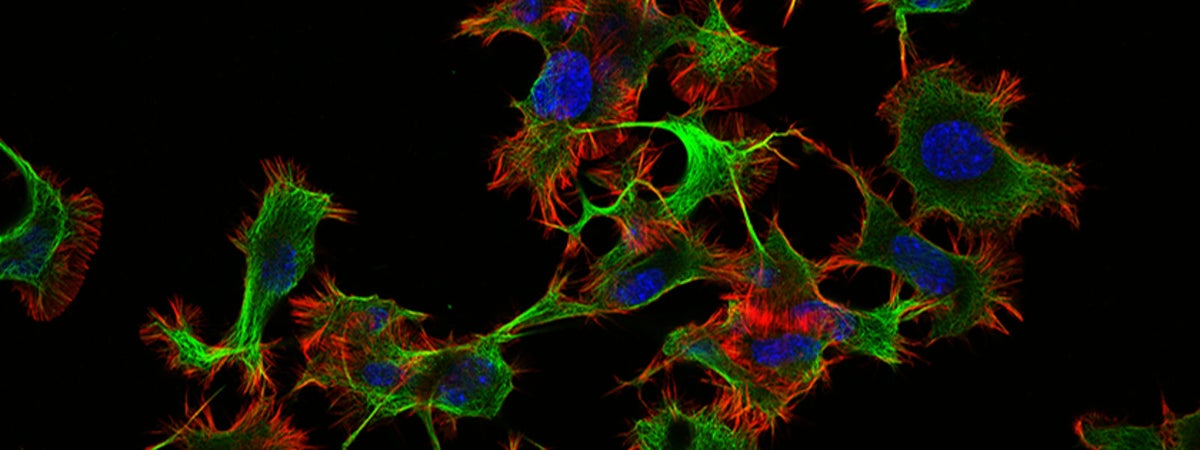 Six Conseils Pour L imagerie De Fluorescence De Cellules Vivantes Six Conseils Pour L imagerie De Fluorescence De Cellules Vivantes