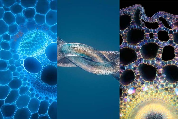 Images de microscopie les plus populaires d’octobre 2021