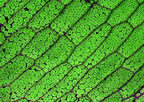 Cellules foliaires d’un gamétophore de mousse observées au microscope