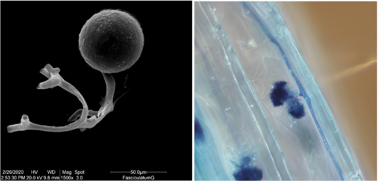 Structures microscopiques de spores mycorhiziennes et de champignons mycorhiziens connus sous le nom d’arbuscules