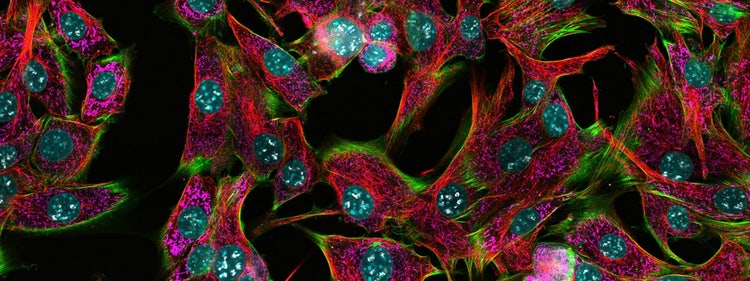 La même image de fluorescence prise avec trois différents réglages du sténotypé.