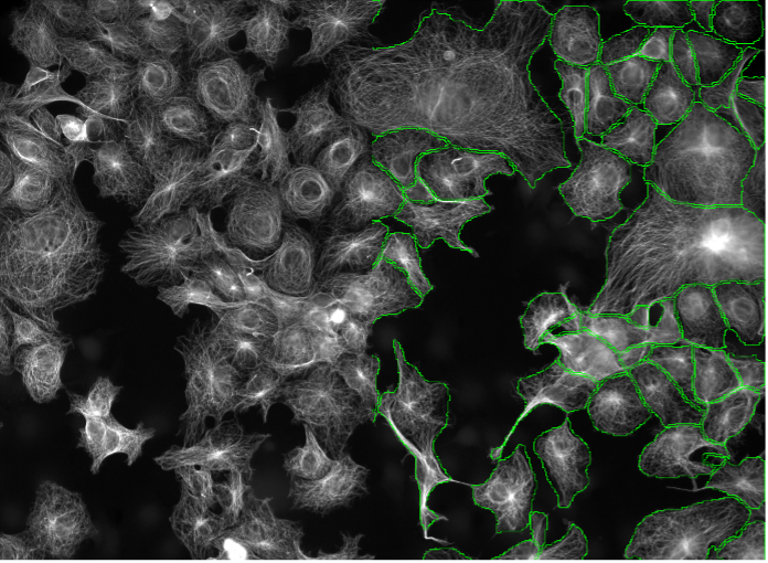 Segmentation d’images de cellules huFIB par apprentissage profond