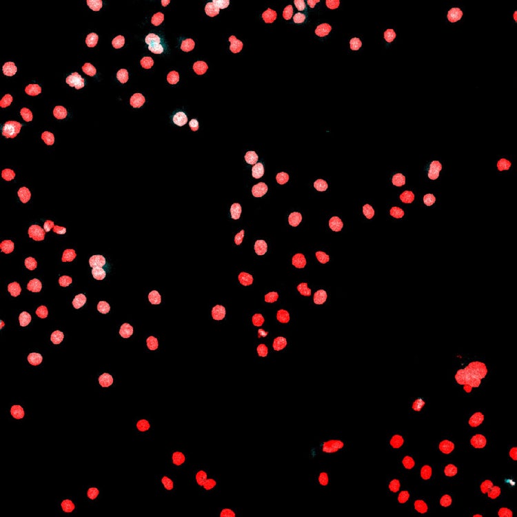 Segmentation d’images de noyaux par apprentissage profond